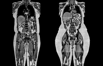 1536824249570901.png image.png